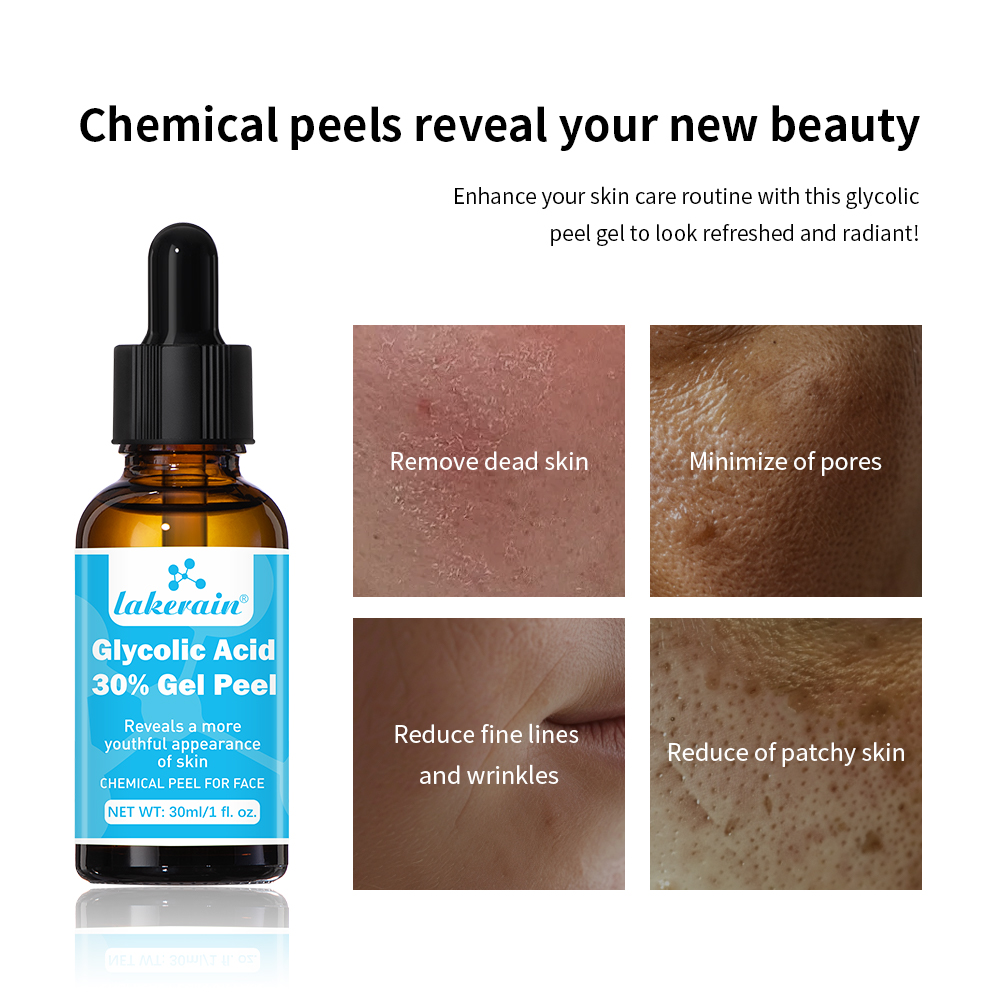 30% ácido glicólico casca gel  - Glycolic Acid Exfoliant avaliação e preço