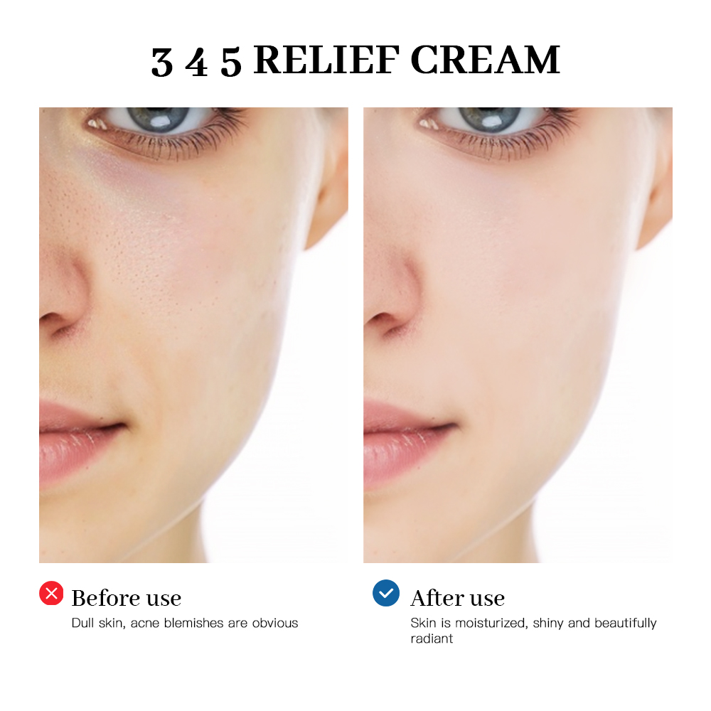 345 Creme de alívio Solução ab - Skincare Retinol avaliação e preço