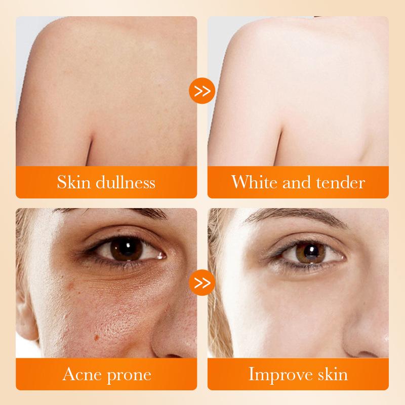 Sabonete Facial SADOER com Áci - Kojic Acid Soap avaliação e preço