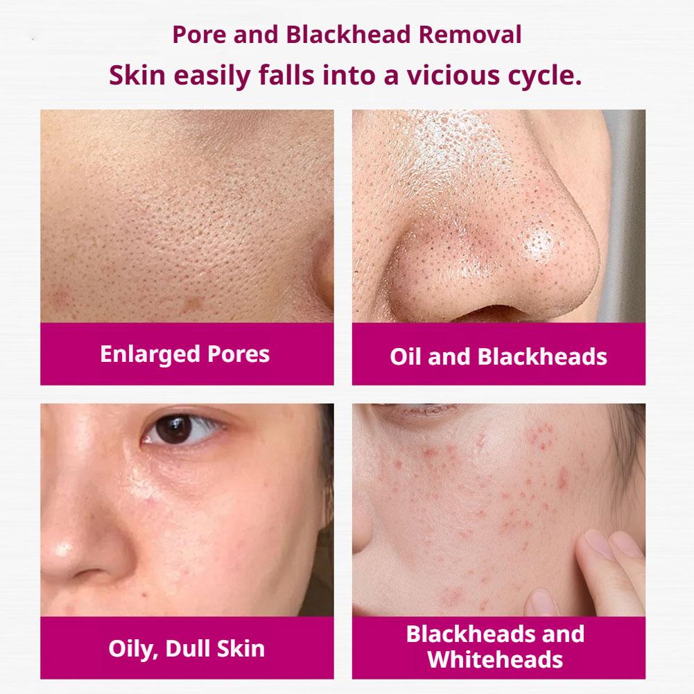 Sérum de Ácido Salicílico para - Glycolic Acid Exfoliant avaliação e preço