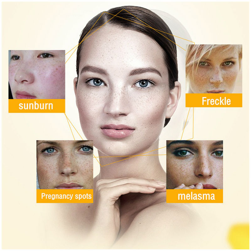 Dimollaure Whitening Freckle C - Skincare Retinol avaliação e preço