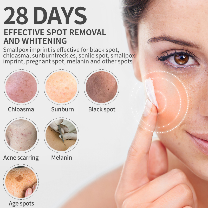 Dimollaure Whitening Freckle C - Skincare Retinol avaliação e preço