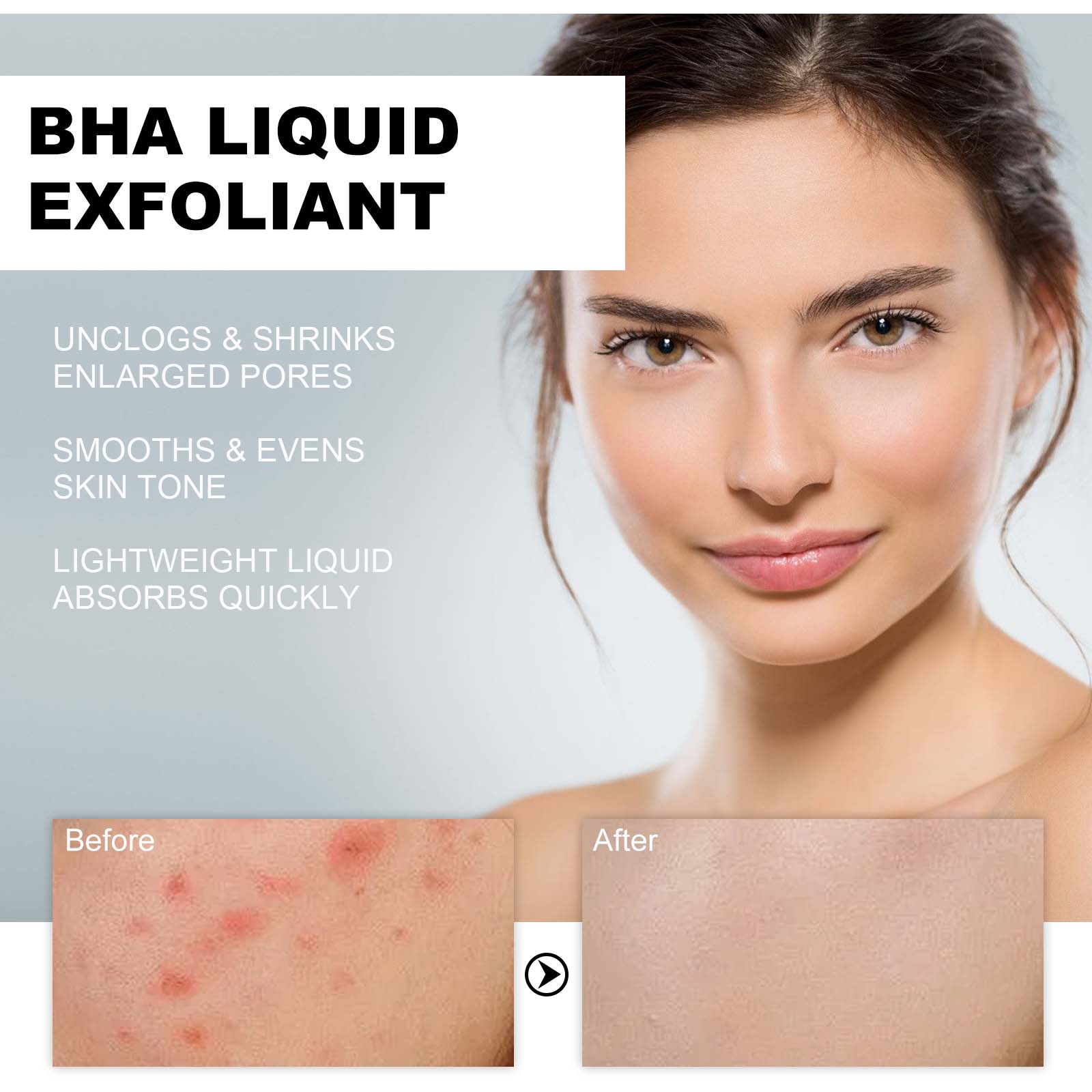 Sérum Exfoliante Líquido com 2 - Glycolic Acid Exfoliant avaliação e preço